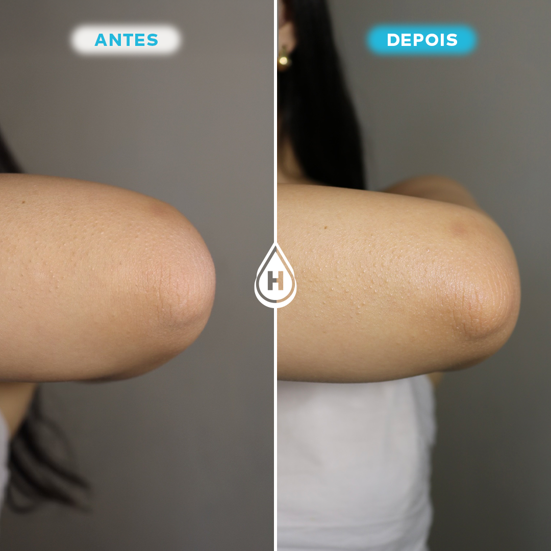 Kit Daily Corpo & Hair - Shampoo e Leave Antifrizz + Loção